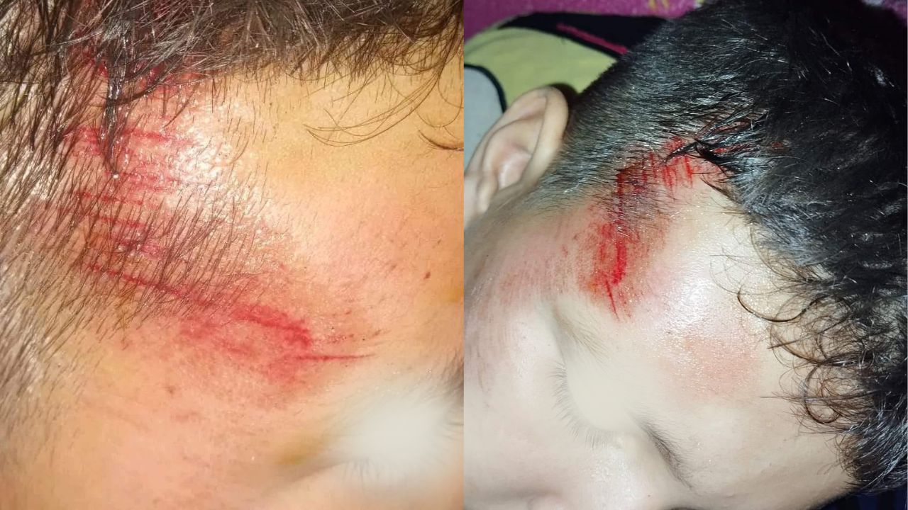 Imagen de Niño hondureño resulta con lesiones en la cabeza por juegos mecánicos; su familia exige mayor seguridad
