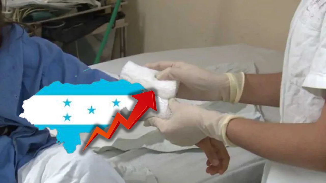 Imagen de Sube a 27 la cifra de niños quemados por pólvora, según Fundaniquem