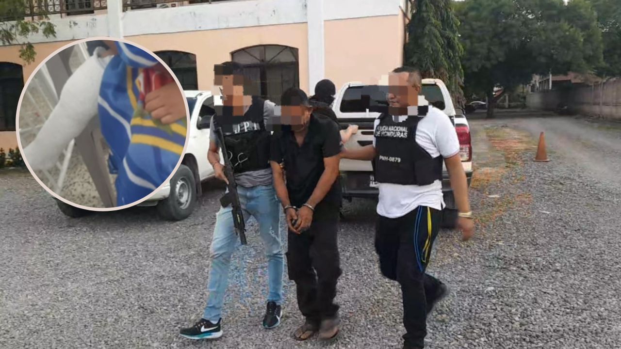 En Choluteca, arrestan a padrastro que fracturó el pie de su hijastro de 3 años durante brutal golpiza