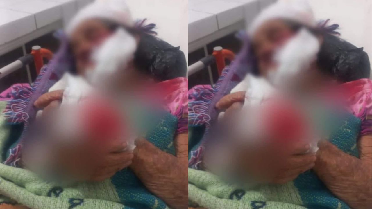Perro atacó a anciana hondureña en su rostro, manos y piernas