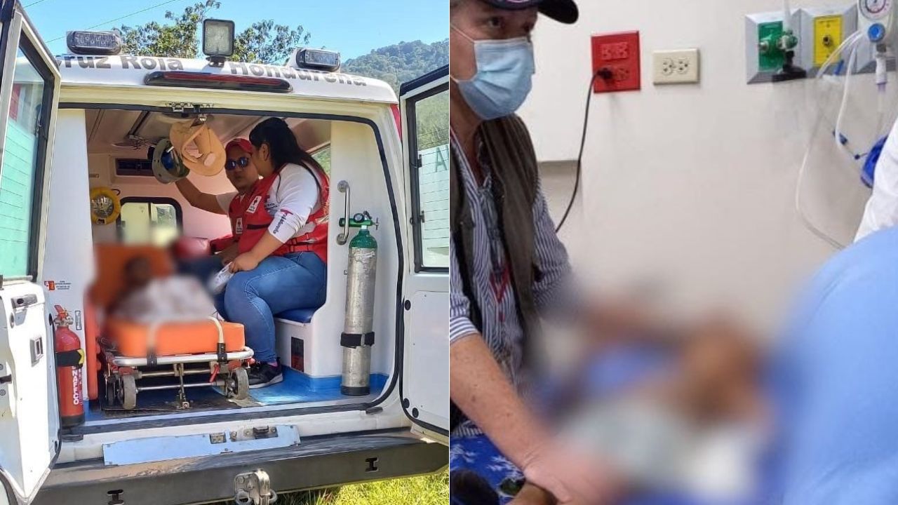 Niño de 5 años sufre amputación de tres dedos y quemaduras por presunto maltrato familiar en SPS