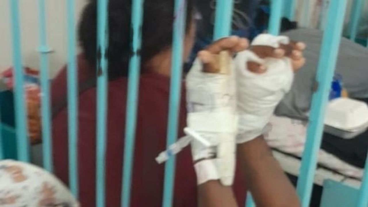 'Se las puso sobre el comal', hondureño castigó a su hijo quemándole las manos