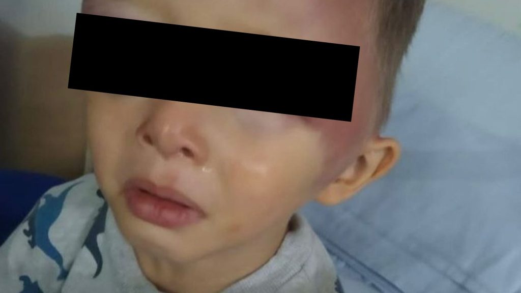 Imagen de cuerpo de nota