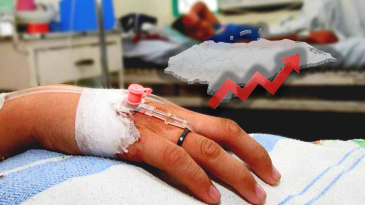 Unos 11,000 casos de dengue registra la Sesal en lo que va del año