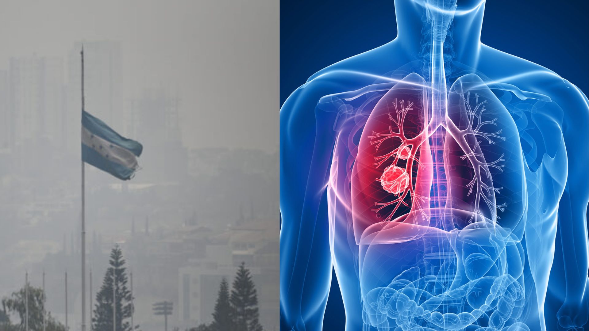 Capa tóxica de contaminación en la capital de Honduras aumenta emergencias respiratorias