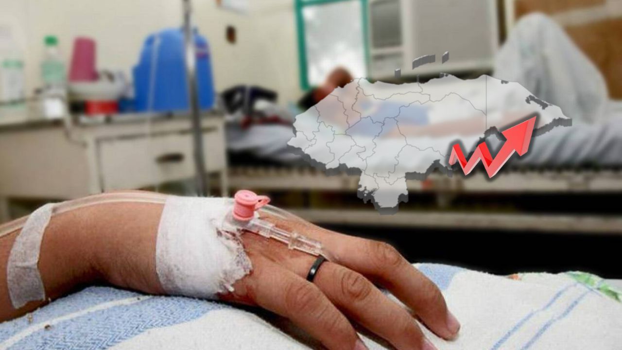 18,000 casos y 19 muertes por dengue en Honduras, confirma Sesal