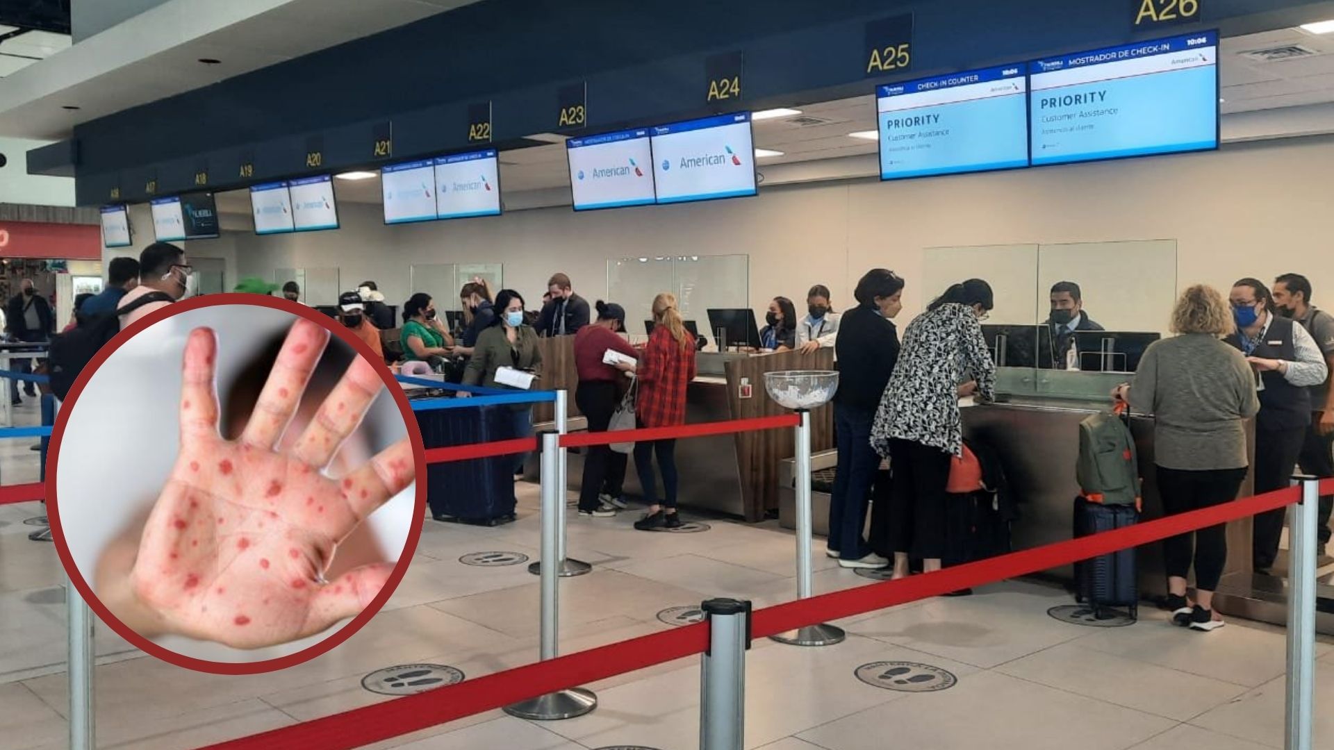 Honduras instala salas de vigilancia en aeropuertos por alerta de viruela del mono