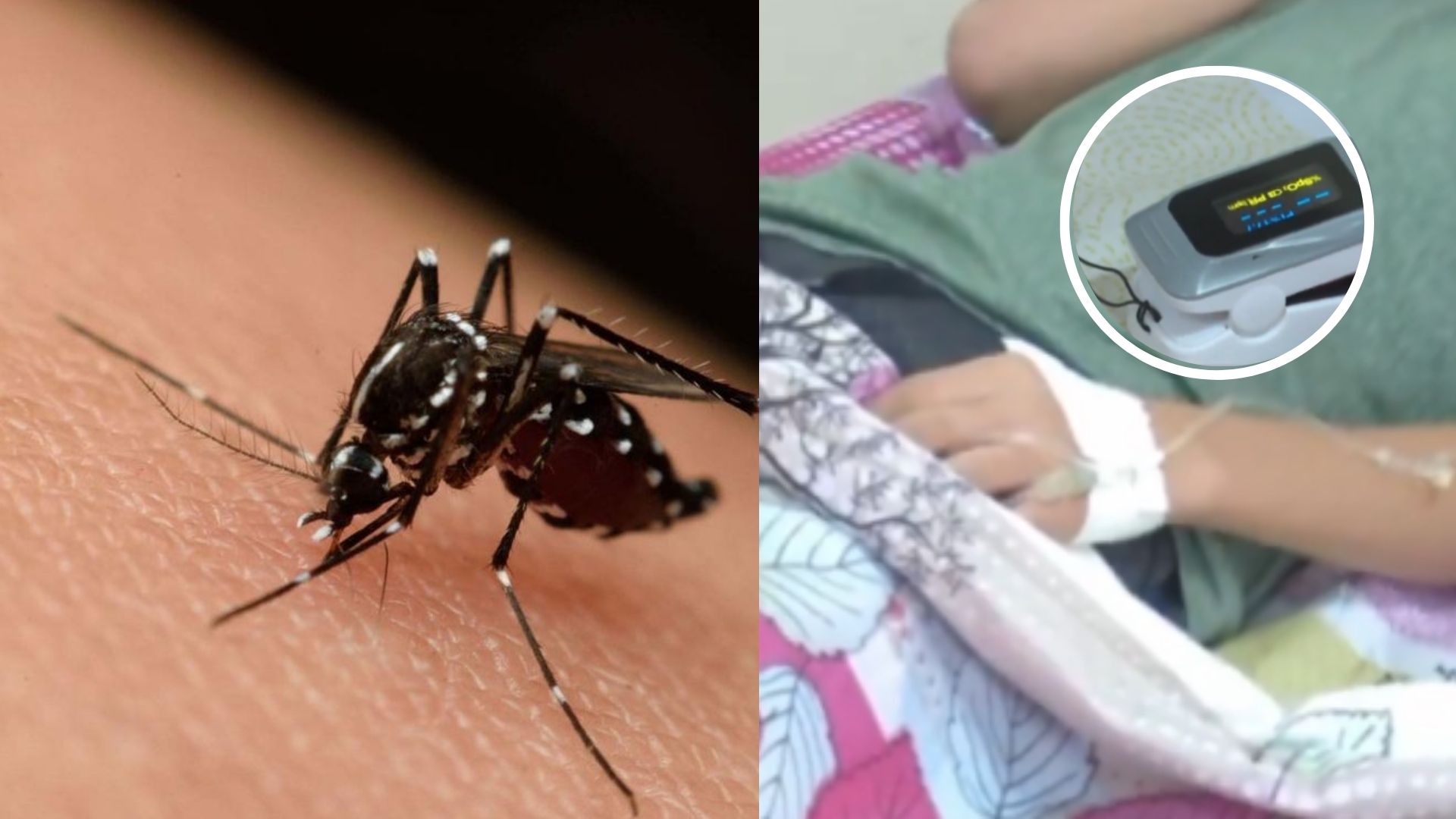 Más de 44 mil menores afectados por dengue en Honduras, según Sesal