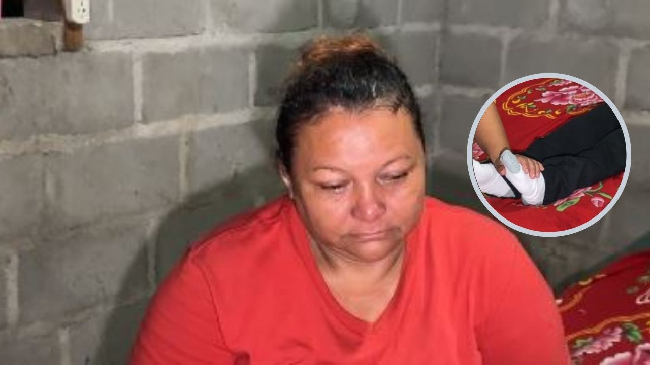 Conmovedora escena de hondureña mientras acaricia los pies de su hijo que murió atropellado