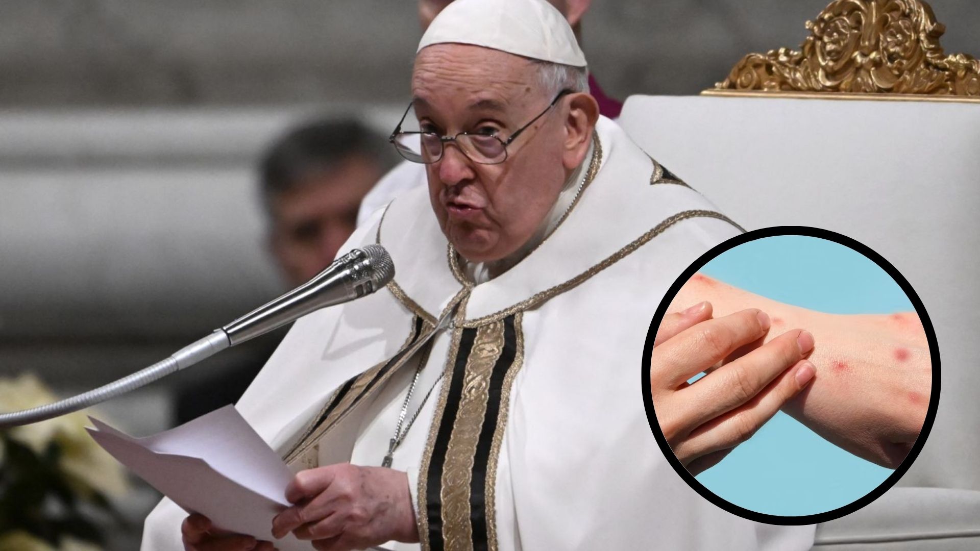 El papa expresa su solidaridad con los enfermos de viruela del mono y urge a la asistencia