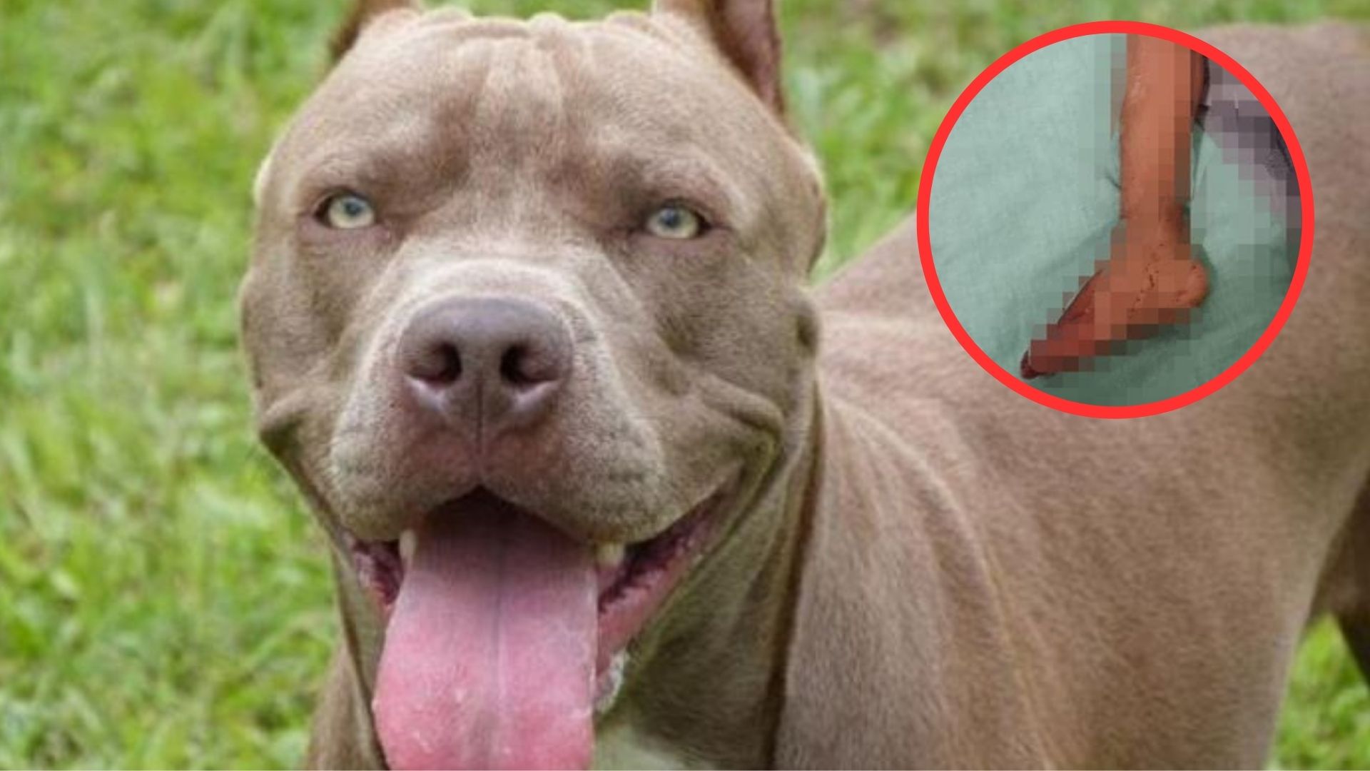 Niño de 2 años es atacado por pitbull con el que intentaba jugar en Comayagua