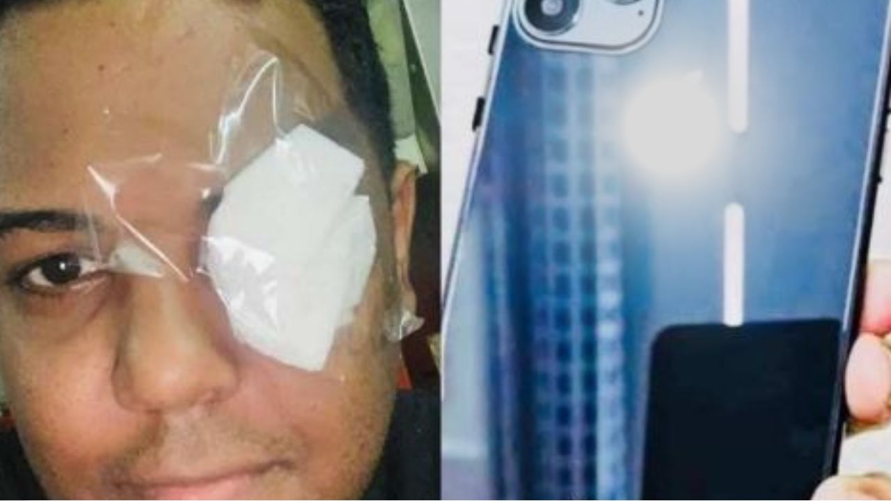 ¿Real?, Joven vendió un ojo para comprar celular de alta gama