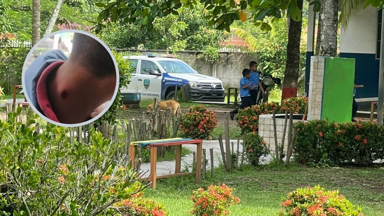 Menor sobrevive tras ser rozado por bala en su cuello mientras estaba en la escuela en Santa Bárbara
