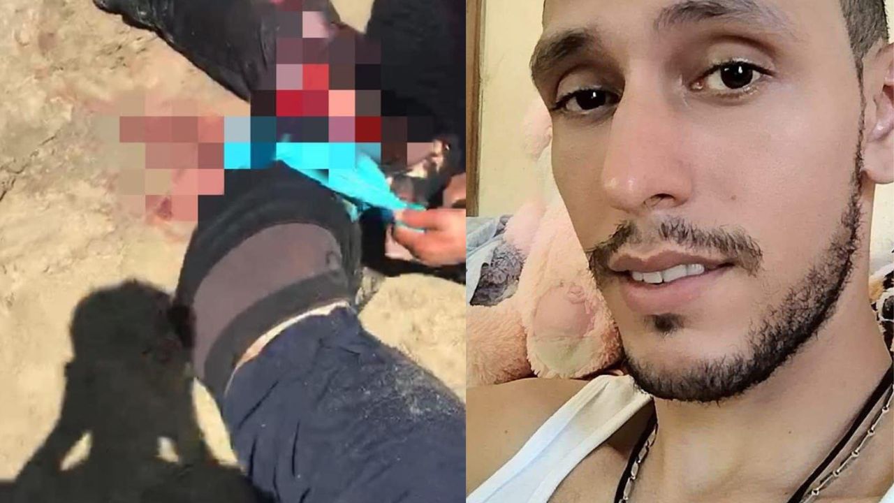 Estas son las secuelas que le dejó a pescador hondureño el ataque de un tiburón