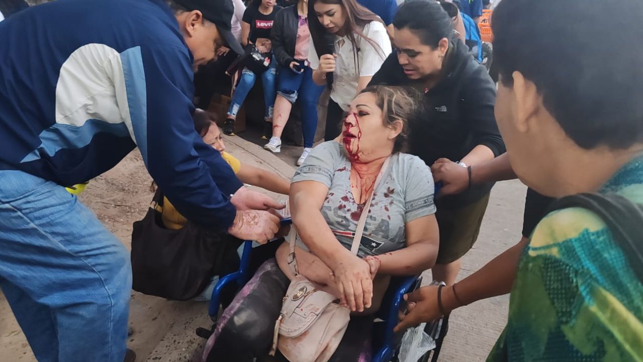 Más de 30 pasajeros heridos en accidente de 'rapidito' que iba peleando vía en bulevar Suyapa de Tegucigalpa