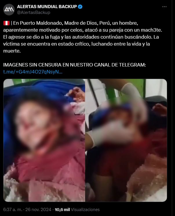 Imagen de cuerpo de nota