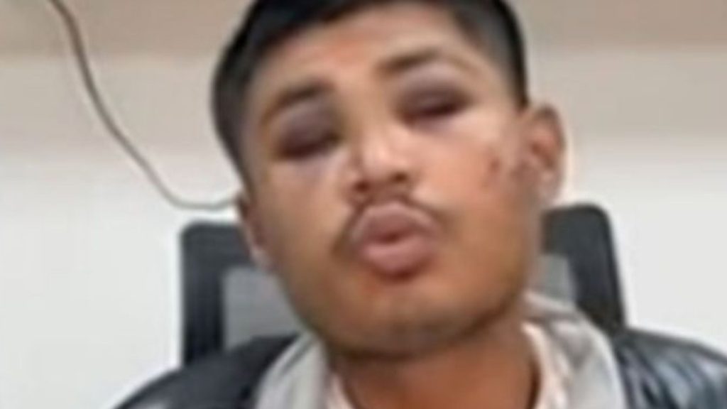 Imagen de cuerpo de nota