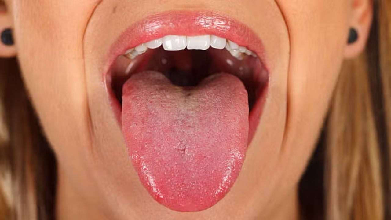 Síntomas de cáncer oral que podrían confundirse con otras afecciones