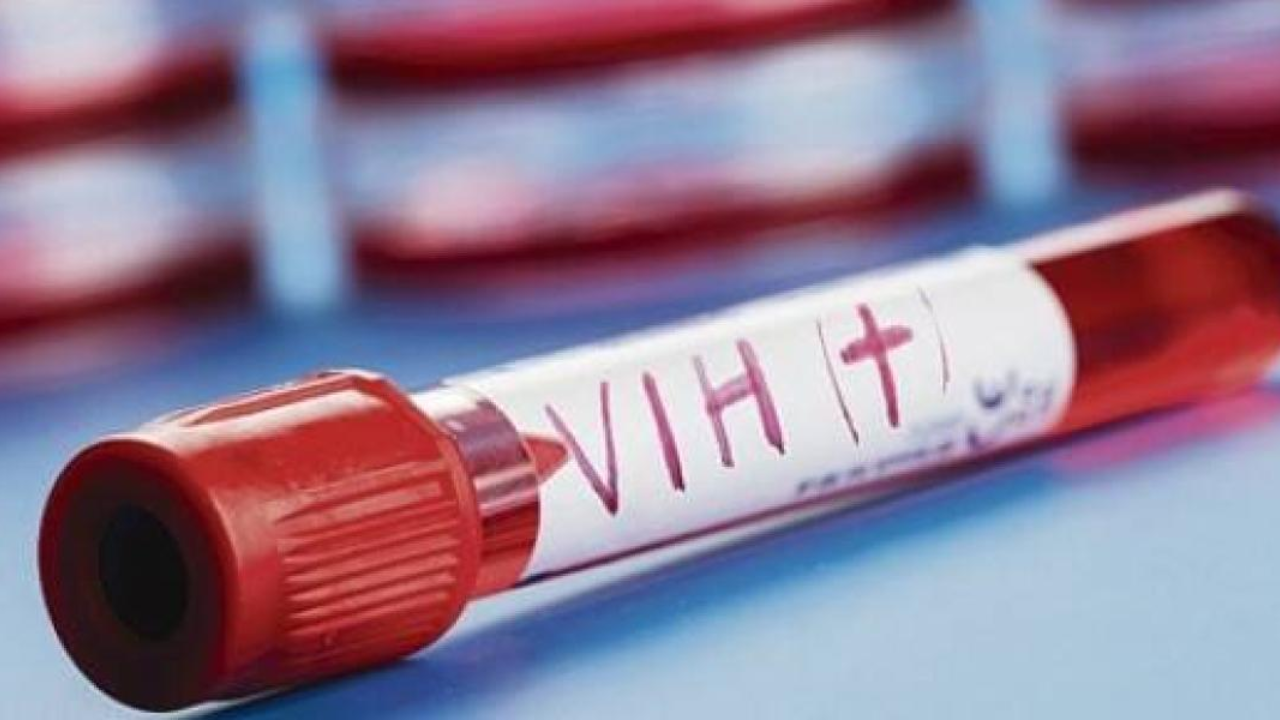 Estos departamentos registran el mayor número de casos de VIH/sida en Honduras