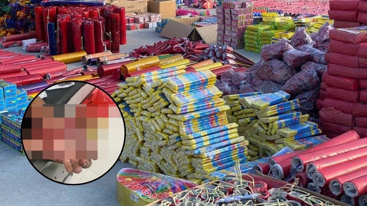 Menor de 15 años, nueva víctima por quemaduras por pólvora en Honduras
