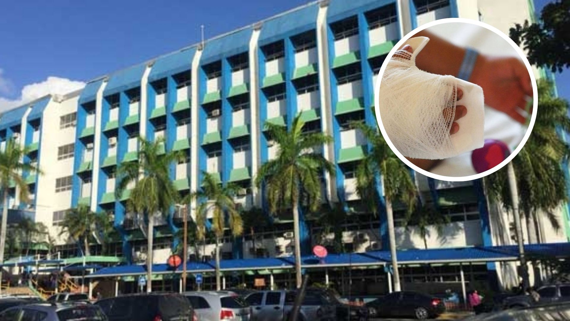 Hospital Mario Catarino Rivas recibe a ocho personas por quemaduras de pólvora durante Nochebuena