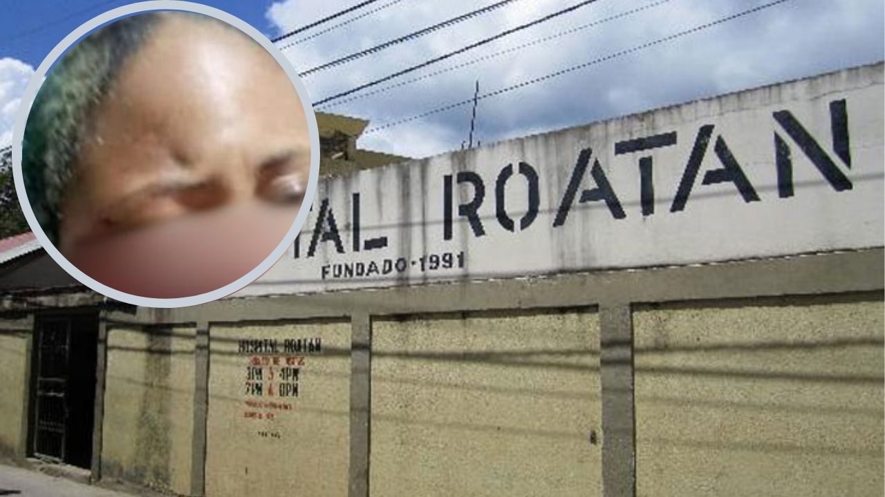 ¿Quién es el hombre que desfiguró el rostro de su novia en Guanaja?