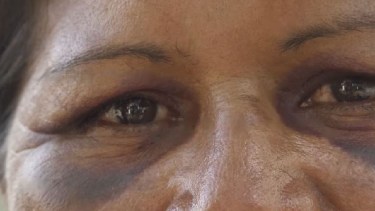 'Si no actúan, lo voy a matar y con gusto lo voy a pagar': hondureña agredida por su esposo exige su captura