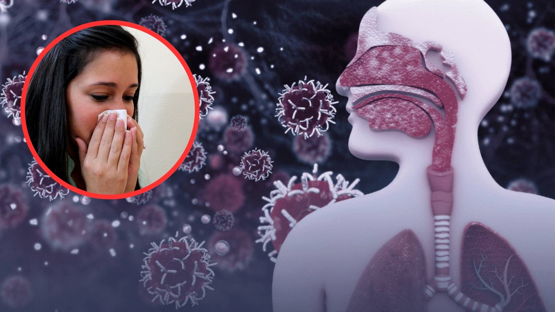 ¿Hay en Honduras casos de metapneumovirus? Esto dice reconocida neumóloga