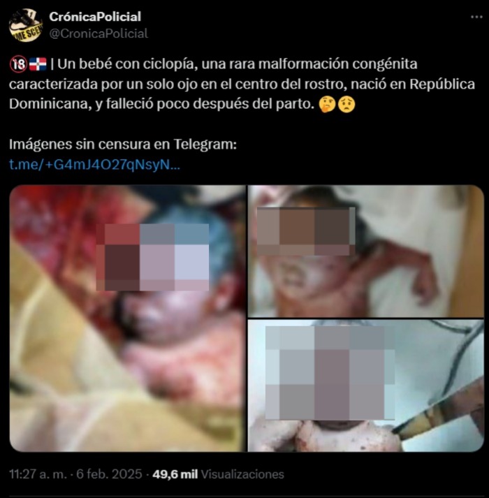 Imagen de cuerpo de nota