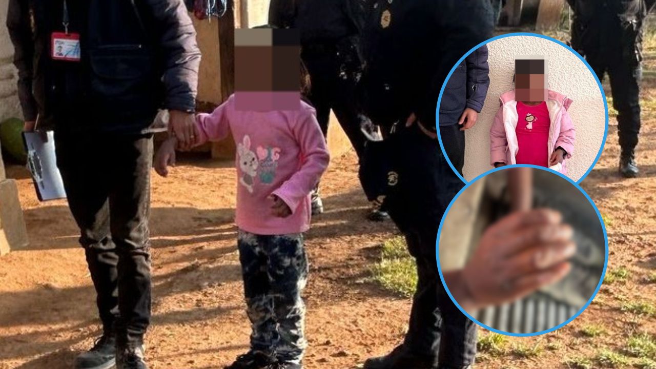 Madre quema las manos de su hija de 8 años por 'no hacer oficio'