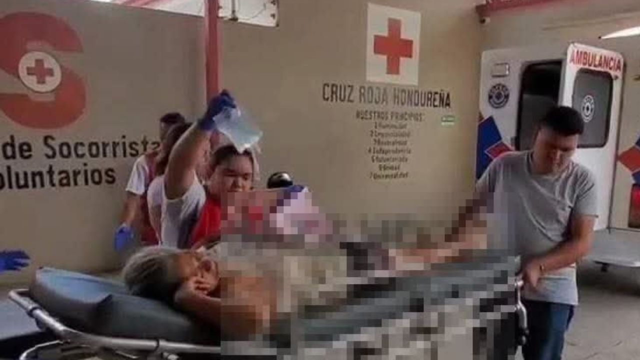 Madre e hija son tiroteadas por pariente en pleito por una cerca en Santa Bárbara