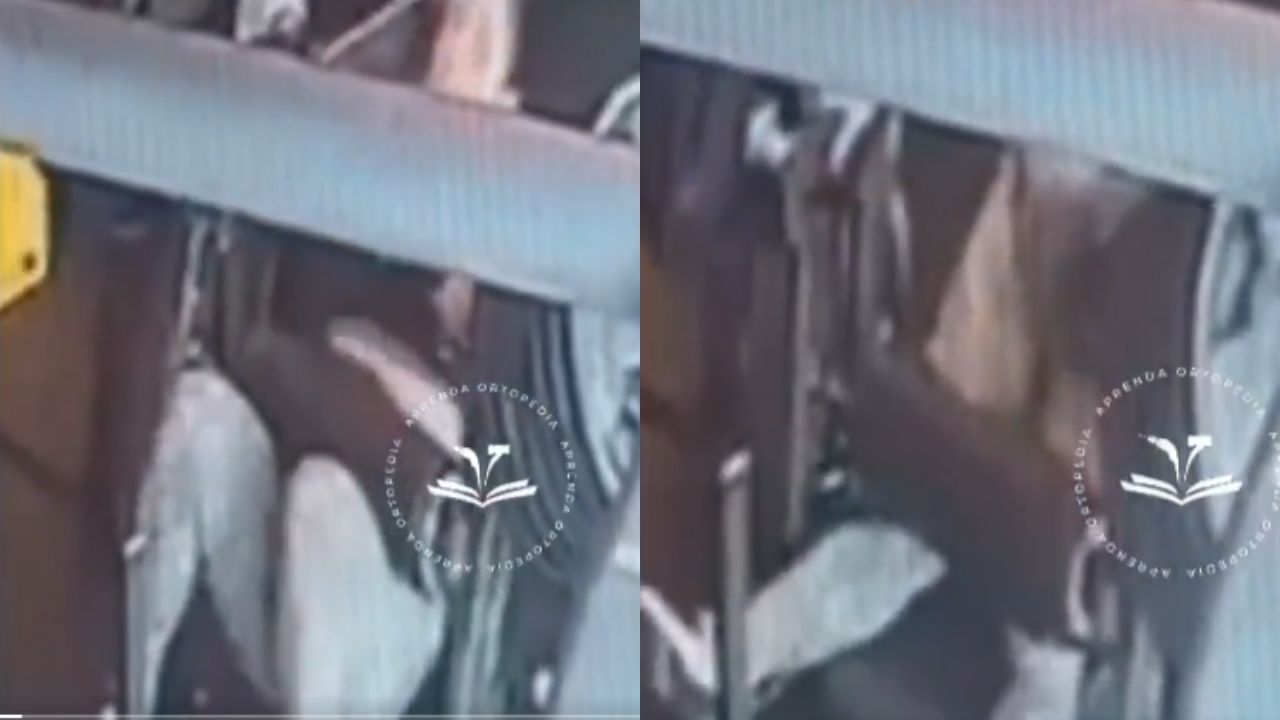 Vídeo: Mujer se rompe las rodillas con máquina mientras hacía ejercicio en gimnasio