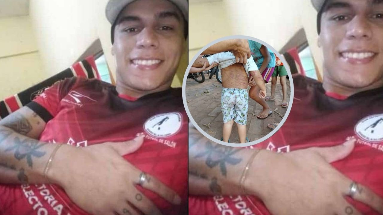 Padrastro golpea a su hijastro de   tres años con un cable
