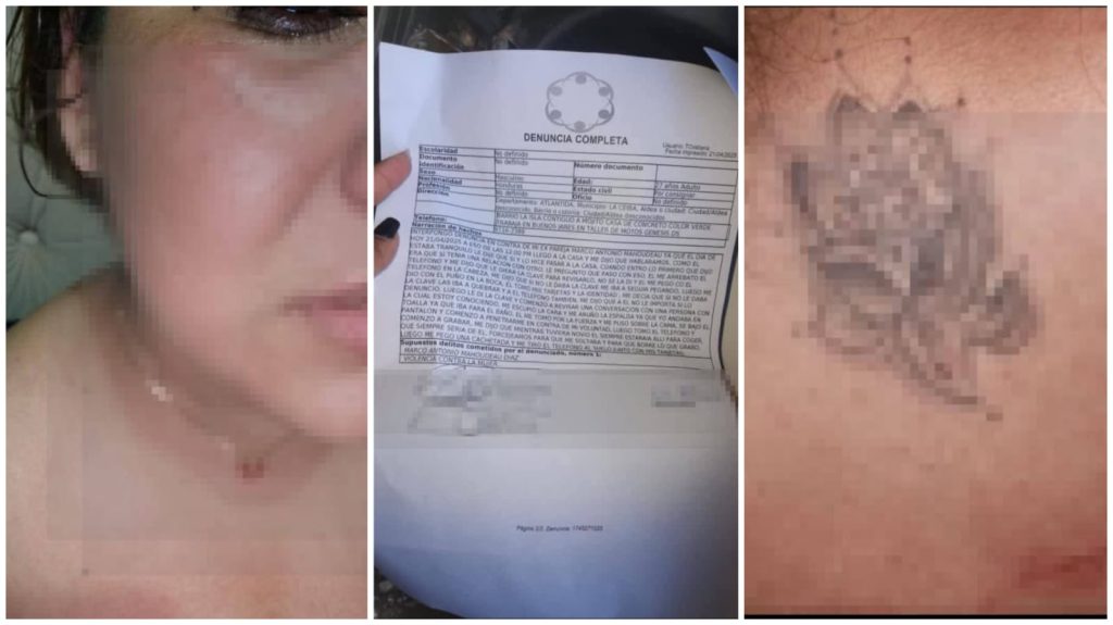 Mujer agredida por su expareja.