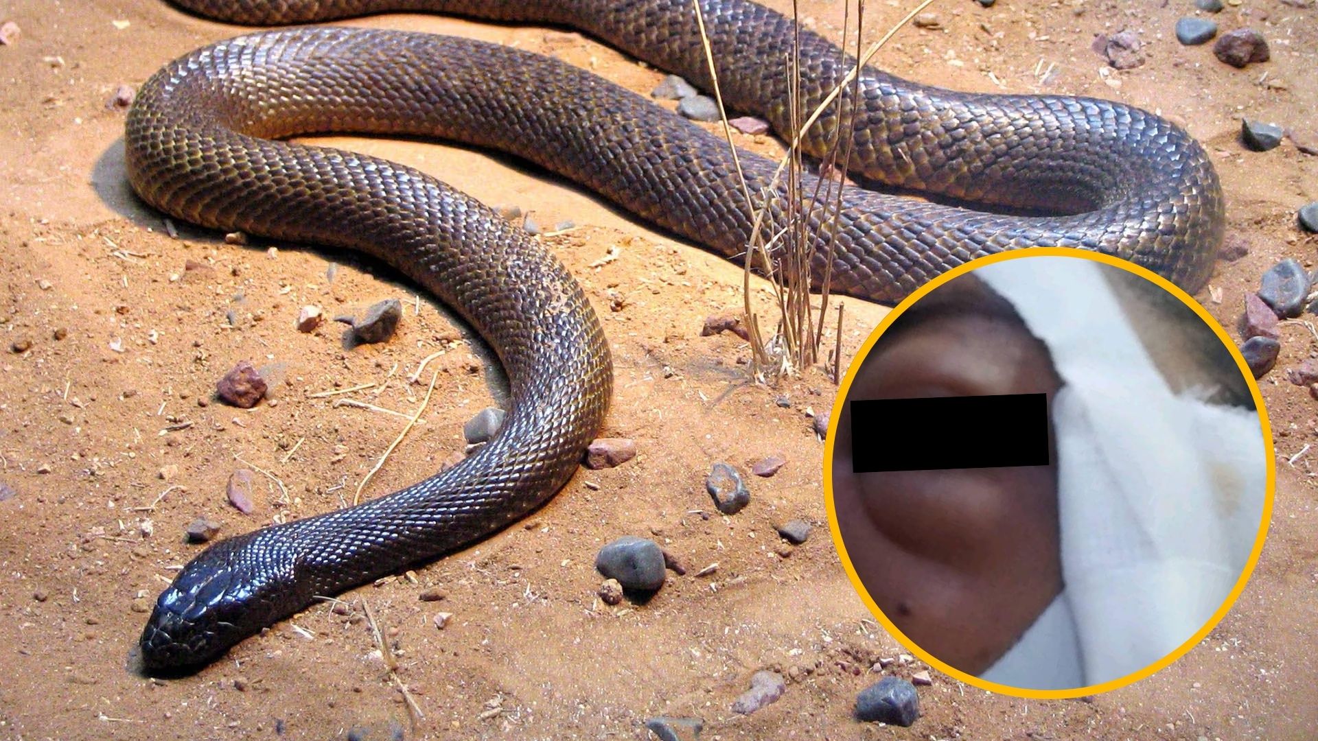 Entre la vida y la muerte hondureña tras ser mordida por serpiente en su casa