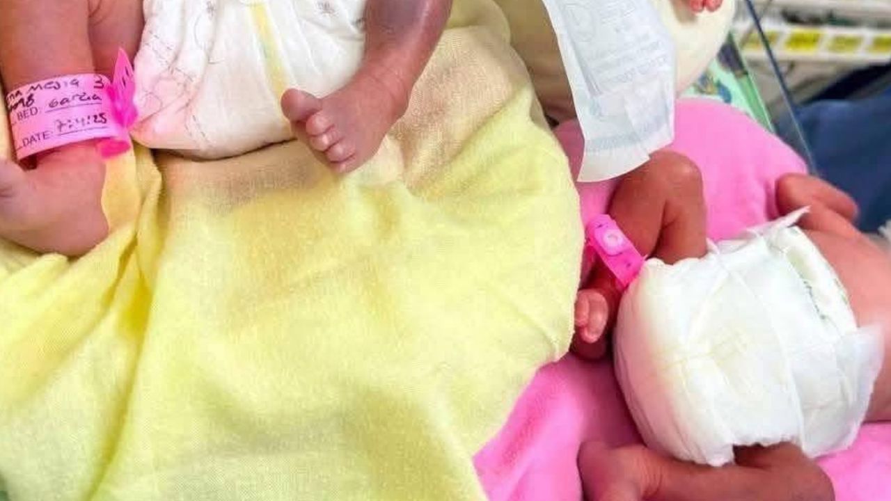 Inmadurez de órganos fue causa de muerte de trillizas en San Pedro Sula