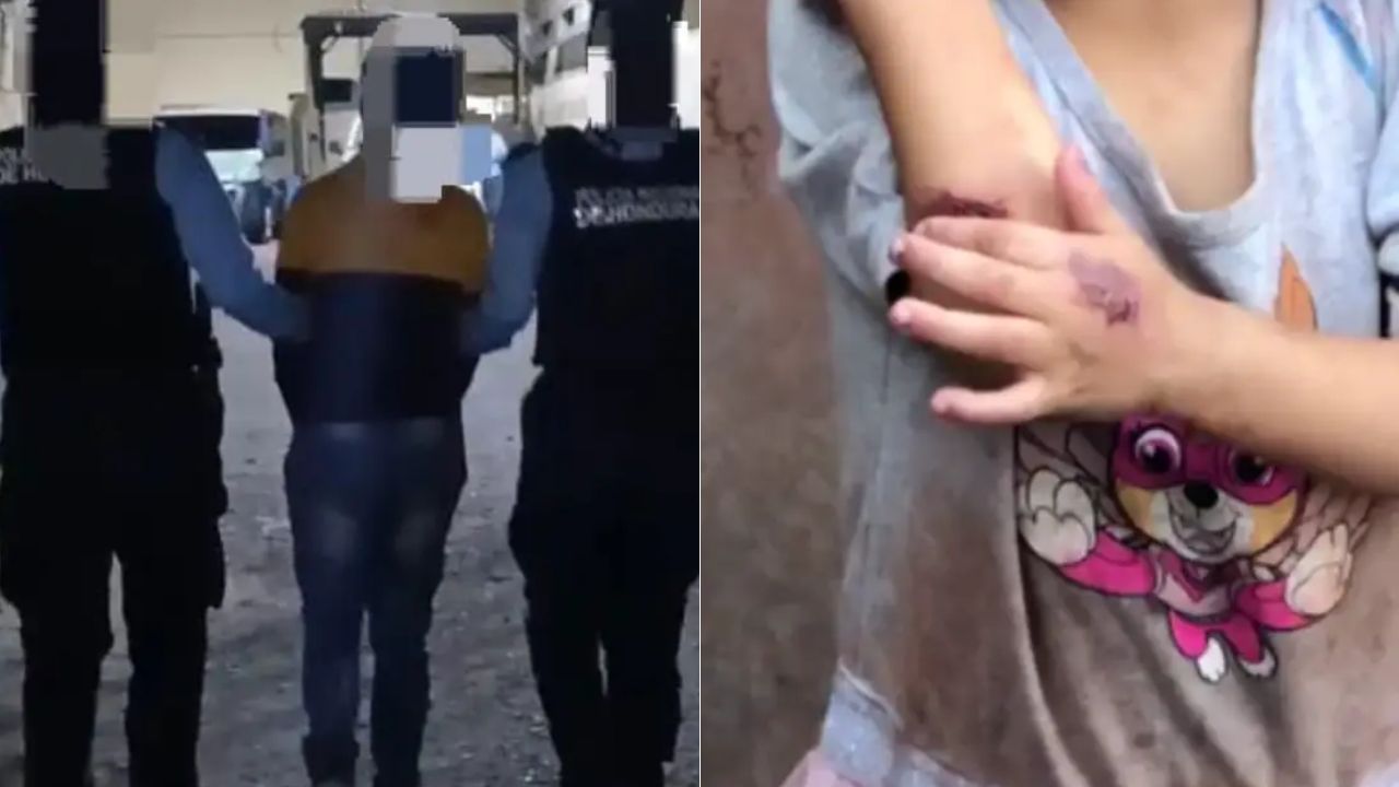 ¿En qué condición están hermanitas maltratadas por su madre en Tegucigalpa?