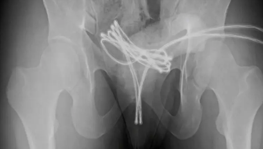 Imagen de cuerpo de nota