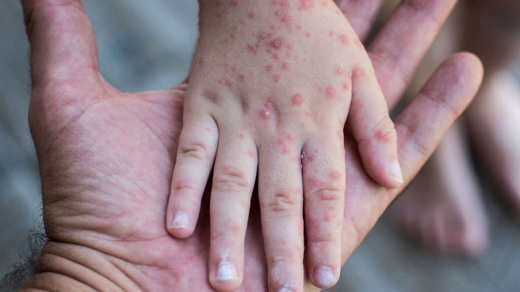 Imagen de cuerpo de nota