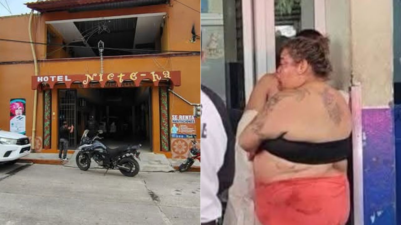 ¿Por qué una mujer dejó herido a su pareja en un motel donde tenían intimidad?