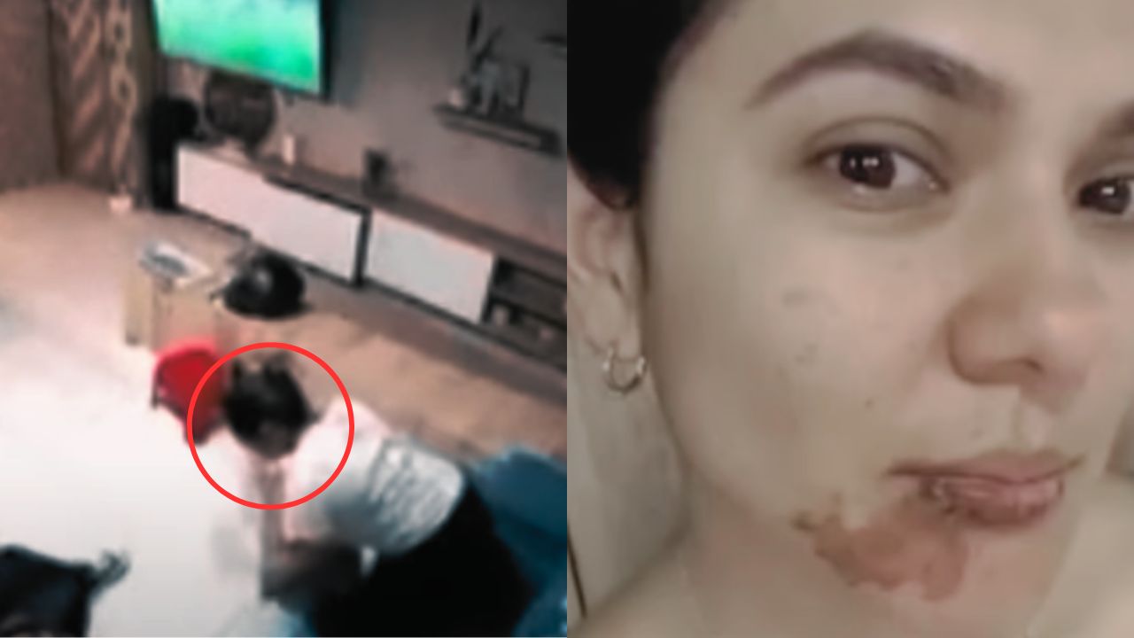 'Te podés casi matar': Mujer, herida cuando 'explotó' una empanada en su cara