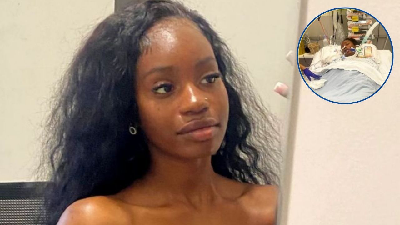 Pierde ambas piernas después de ser diagnosticada con gripe común; quería ser modelo