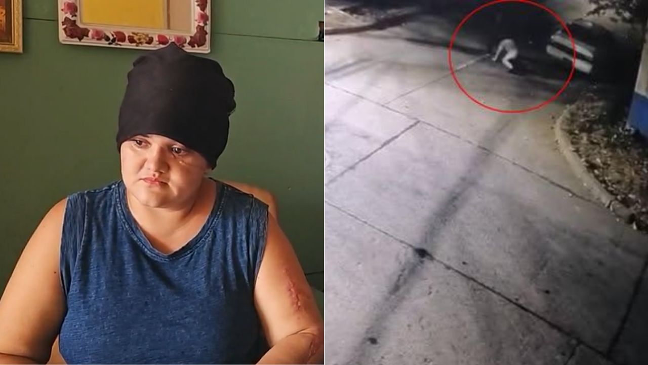 'Buscó gasolina': Sobreviviente revela su versión tras ser atacada a machetazos en SPS