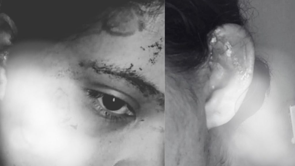 Imagen de cuerpo de nota