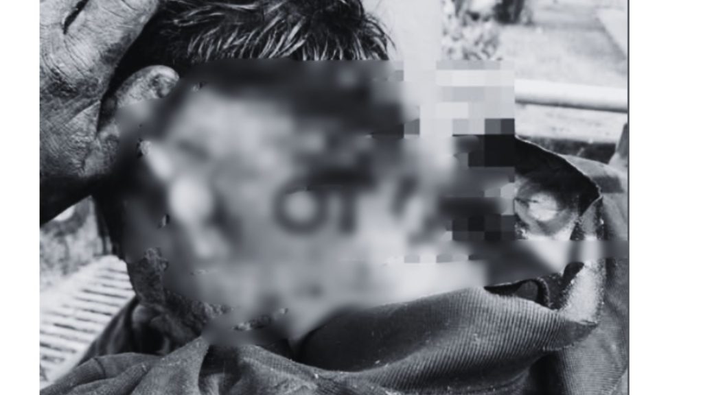 Imagen de cuerpo de nota