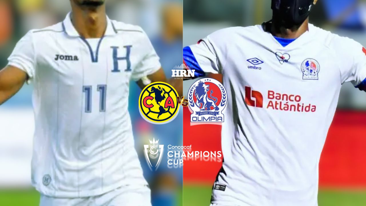 América vs Olimpia: jugador va por su tercer 'Aztecazo' ¿Lo logrará?