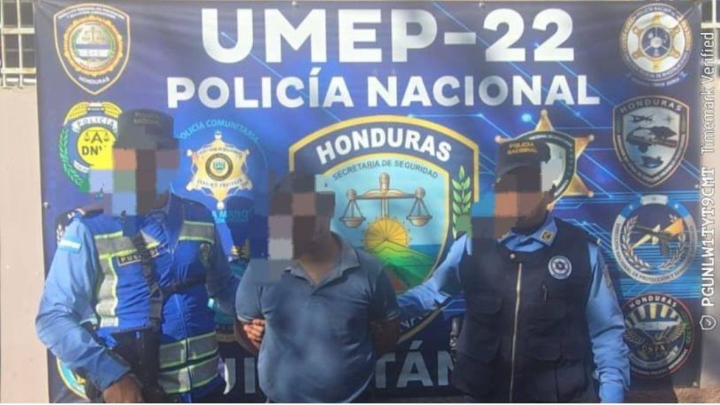 Al sospechoso le decomisaron el carro involucrado en el atropellamiento del agente policial. 