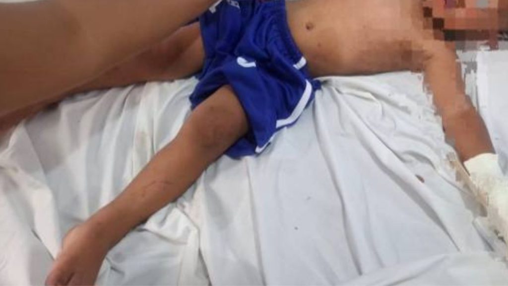 Imagen de cuerpo de nota