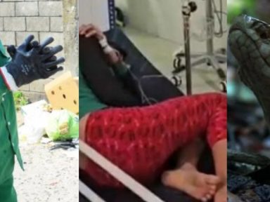 Imagen de Así atacaron serpientes venenosas a un trabajador en SPS y una niña en Danlí