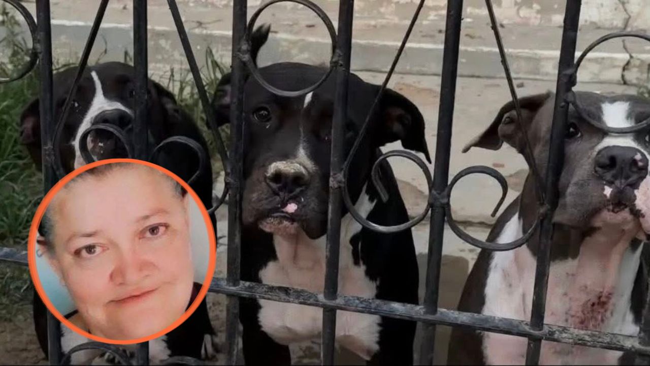 Imagen de Tras cuatro días de agonía muere señora atacada por pitbulls en La Ceiba
